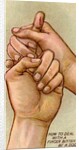 Bleeding finger by Anonymous