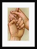Bleeding finger by Anonymous
