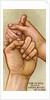 Bleeding finger by Anonymous