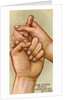 Bleeding finger by Anonymous