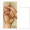 Bleeding finger by Anonymous