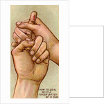 Bleeding finger by Anonymous