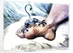 The Gout by Anonymous