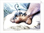 The Gout by Anonymous