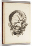 Engraving of a child in the womb by William Smellie