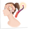 Cerebrovascular neurol. disease by Anonymous