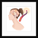 Cerebrovascular neurol. disease by Anonymous