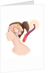 Cerebrovascular neurol. disease by Anonymous
