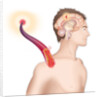 Cerebrovascular neurol. disease by Anonymous