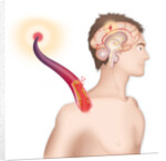 Cerebrovascular neurol. disease by Anonymous