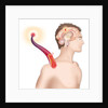 Cerebrovascular neurol. disease by Anonymous