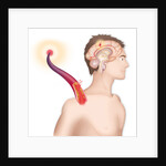 Cerebrovascular neurol. disease by Anonymous