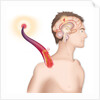 Cerebrovascular neurol. disease by Anonymous
