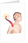 Cerebrovascular neurol. disease by Anonymous