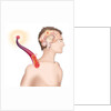 Cerebrovascular neurol. disease by Anonymous