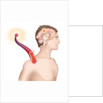Cerebrovascular neurol. disease by Anonymous