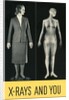 X-Rays and You by Anonymous