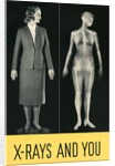 X-Rays and You by Anonymous