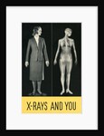 X-Rays and You by Anonymous