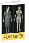 X-Rays and You by Anonymous