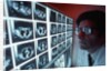 1980s doctor examining CAT scan by Anonymous