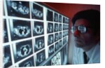 1980s doctor examining CAT scan by Anonymous