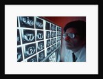 1980s doctor examining CAT scan by Anonymous