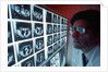 1980s doctor examining CAT scan by Anonymous