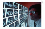 1980s doctor examining CAT scan by Anonymous