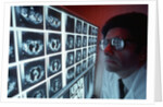 1980s doctor examining CAT scan by Anonymous