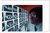 1980s doctor examining CAT scan by Anonymous