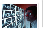 1980s doctor examining CAT scan by Anonymous