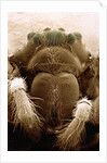 Microscopic View of Black Widow by Anonymous