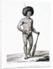 Papua Islands: Ichthyosis Leprosy Book Illustration by Anonymous