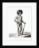 Papua Islands: Ichthyosis Leprosy Book Illustration by Anonymous