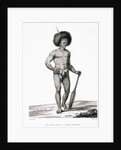 Papua Islands: Ichthyosis Leprosy Book Illustration by Anonymous