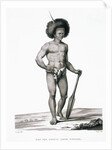 Papua Islands: Ichthyosis Leprosy Book Illustration by Anonymous