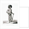 Papua Islands: Ichthyosis Leprosy Book Illustration by Anonymous