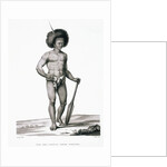 Papua Islands: Ichthyosis Leprosy Book Illustration by Anonymous