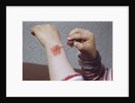 Placing Medicine on Infection by Anonymous