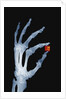 Skeletal Hand Holding Computer Chip by Anonymous
