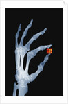 Skeletal Hand Holding Computer Chip by Anonymous