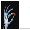 Skeletal Hand Holding Computer Chip by Anonymous