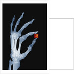 Skeletal Hand Holding Computer Chip by Anonymous