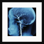 X-Ray of Human Head by Anonymous