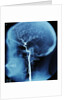 X-Ray of Human Head by Anonymous