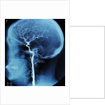 X-Ray of Human Head by Anonymous