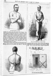 Illustrations of a Strait Jacket by Anonymous
