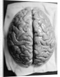 The Human Brain by Anonymous