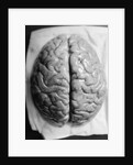 The Human Brain by Anonymous